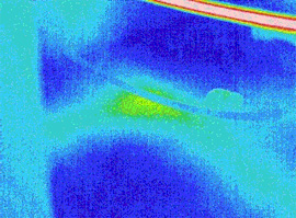 Termografia infrarossi